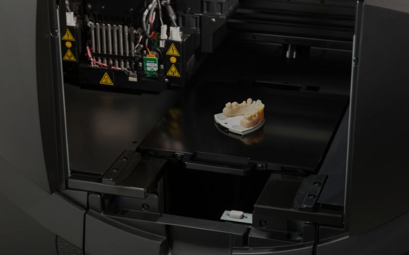 reparar una protesis dental como ayuda la impresion 3d 1