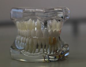 prótesis dentales