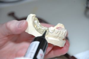 prótesis dentales