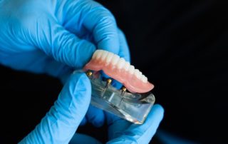 impresora 3d en el sector dental