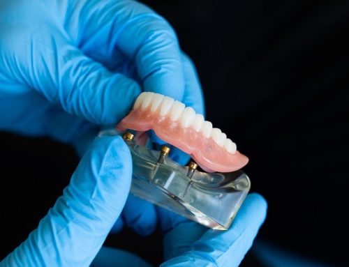 La importancia de la impresora 3D en el sector dental